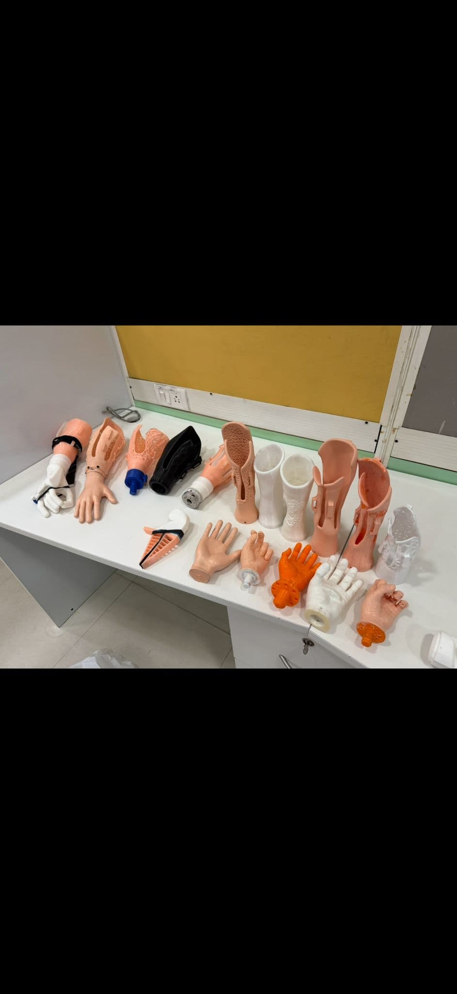 Range of 3D printed prosthetic designs