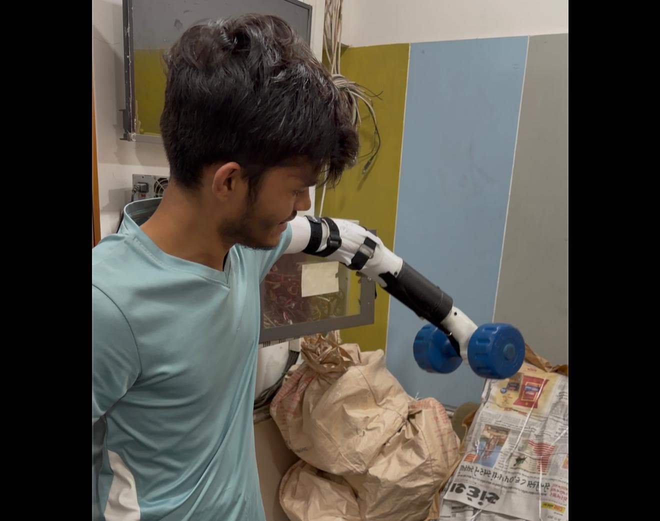 Akrolimb prosthetic fitting session with a patient