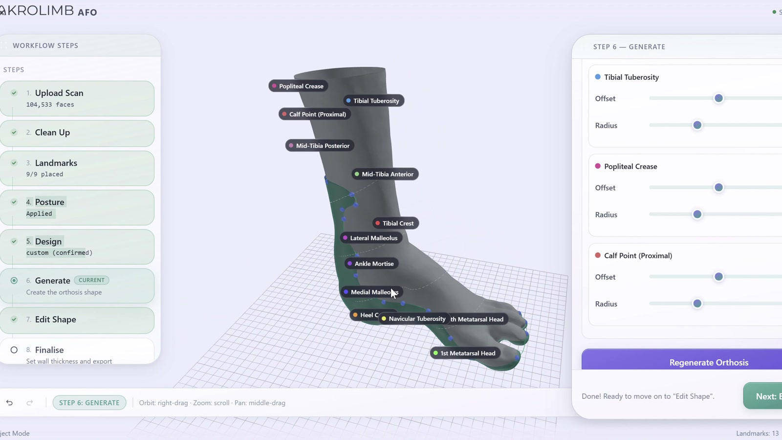 Akrolimb AFO design software — landmarking and orthosis generation